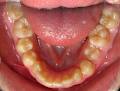 Davis Orthodontics image 3