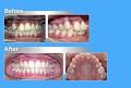 Orthodontist Montreal image 3