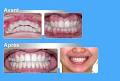 Orthodontist Montreal image 4