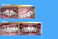 Orthodontist Montreal image 6