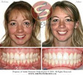 Smile Elements Orthodontics image 2