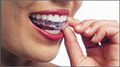 Smile Elements Orthodontics image 4