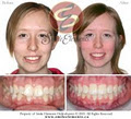 Smile Elements Orthodontics logo