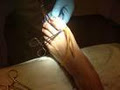 Podiatrist Toronto - Custom Orthotics Andrew S Klayman image 4