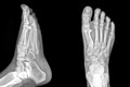 The Foot Institute Red Deer image 3
