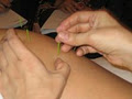 Acupuncture, Reiki and Energy Healing, Thornhill Clinic image 1