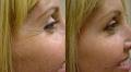 Dr. Matta Cosmetic and Laser Clinic image 5
