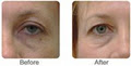 Miracle Laser & Skin Care image 1