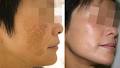Radiance Skin Rejuvenation Centre image 4