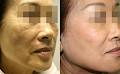 Radiance Skin Rejuvenation Centre image 5