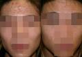 Radiance Skin Rejuvenation Centre image 6
