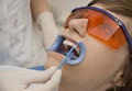 Just Smile - Dental Hygiene and Teeth whitening Services image 2