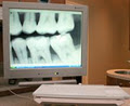 Markland Dental Centre image 5