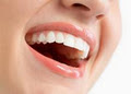 PEARL Teeth Whitening Spa image 3