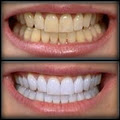 Teeth Whitening Express logo