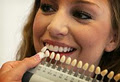 The Smile Spa - Professional Teeth Whitening & Esthetics image 3