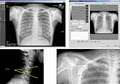Canadian X-Ray Supplies & Services image 1