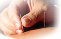 Essential Balance Hollistic Health Acupuncture Clinic image 3