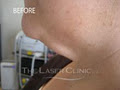 THE LASER CLINIC Your Clinic Your Results (TM) image 3