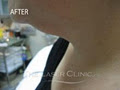 THE LASER CLINIC Your Clinic Your Results (TM) image 4