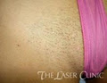 THE LASER CLINIC Your Clinic Your Results (TM) image 5