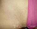THE LASER CLINIC Your Clinic Your Results (TM) image 6